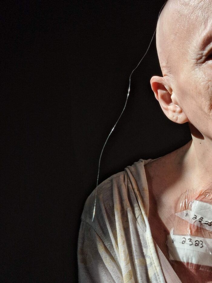  Mom’s Last Hair. Self-Portrait. 4 Months Of Chemo Remaining For This Incredible Woman