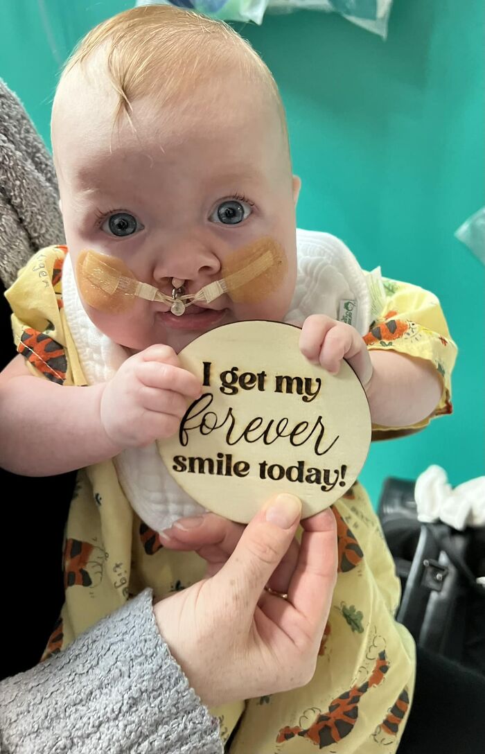 The Heart-Warming Story Of One Photograph: An Image Of A Baby With A Cleft Lip, Making Her Story Go Viral The Heart-Warming Story Of One Photograph: An Image Of A Baby With A Cleft Lip, Making Her Story Go Viral