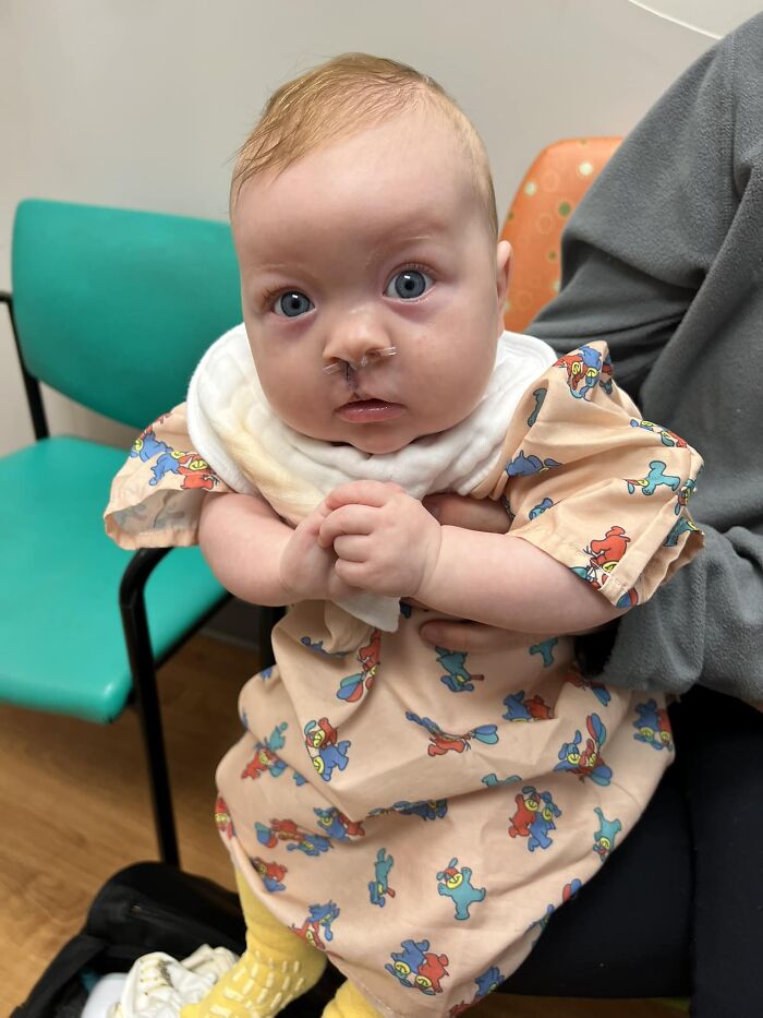 The Heart-Warming Story Of One Photograph: An Image Of A Baby With A Cleft Lip, Making Her Story Go Viral The Heart-Warming Story Of One Photograph: An Image Of A Baby With A Cleft Lip, Making Her Story Go Viral