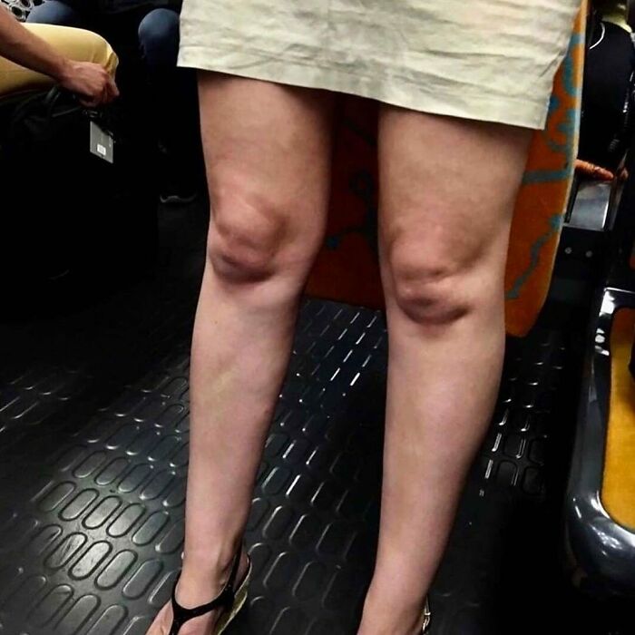 Non-Aesthetic-Things-Pics