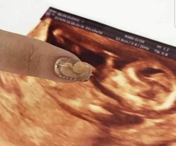 50 Ironic Pics That Perfectly Showcase The Absurdity Of Capitalism, As Shared On This Group