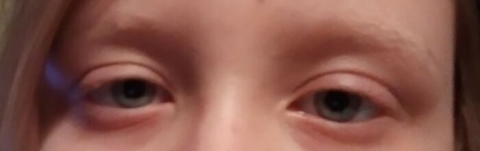 Picture Of Me Without My Glasses Because Of The Glare Lol