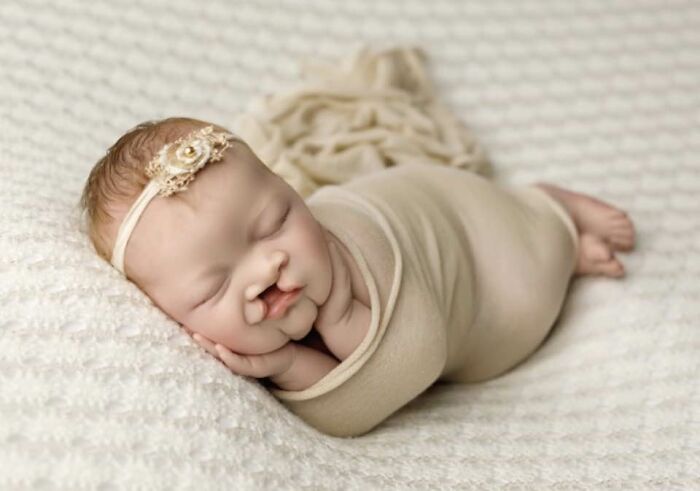 The Heart-Warming Story Of One Photograph: An Image Of A Baby With A Cleft Lip, Making Her Story Go Viral The Heart-Warming Story Of One Photograph: An Image Of A Baby With A Cleft Lip, Making Her Story Go Viral