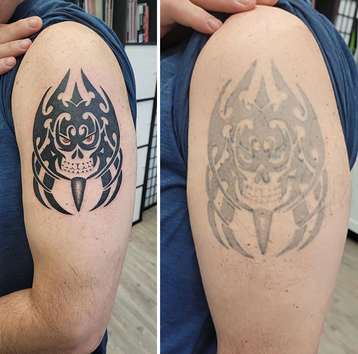 Aged tattoos showing ink fading over time on a person's arm, comparing fresh and old designs.