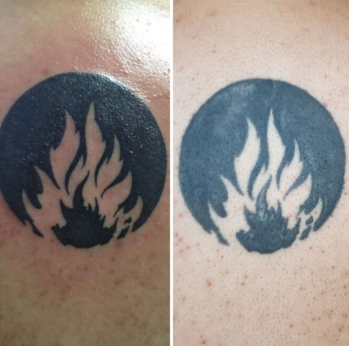 Aged tattoo showing ink changes over time with two side-by-side images of a black flame design.