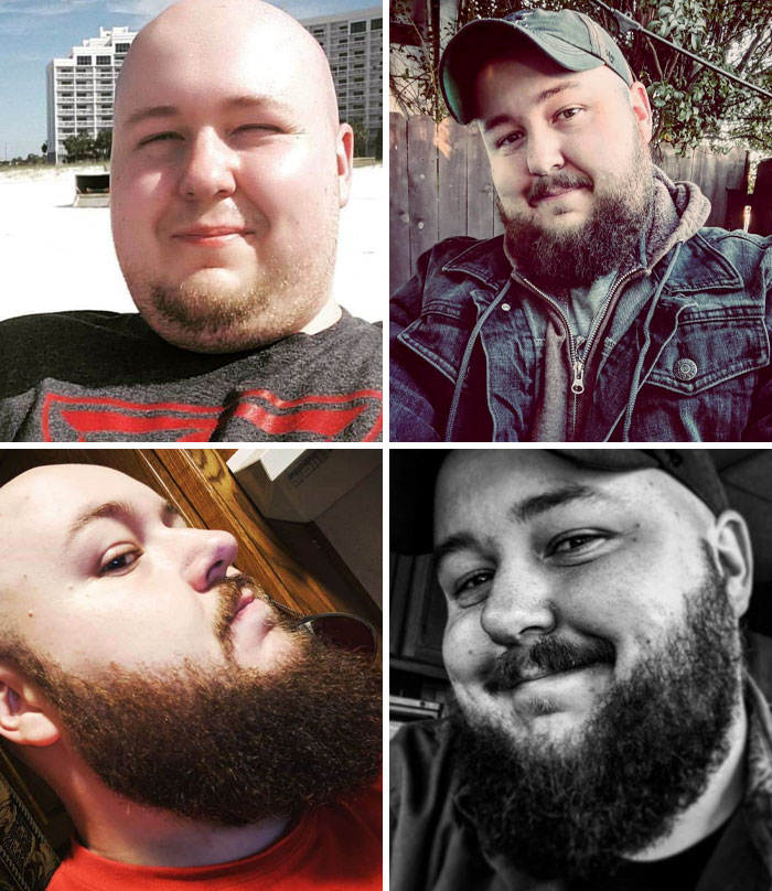 I Never Grew A Beard Because My Ex Thought It Was Too Thin. I Gave It A Shot After We Split, And Had Nothing But Compliments Since. Let It Grow, Boys