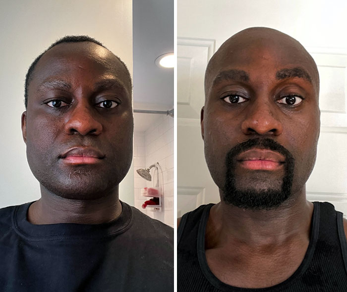 33-Year-Old Math Teacher Here. I Decided To Shave My Head Bald And Grow A Goatee After Months Of Being Insecure About My Receding Hairline