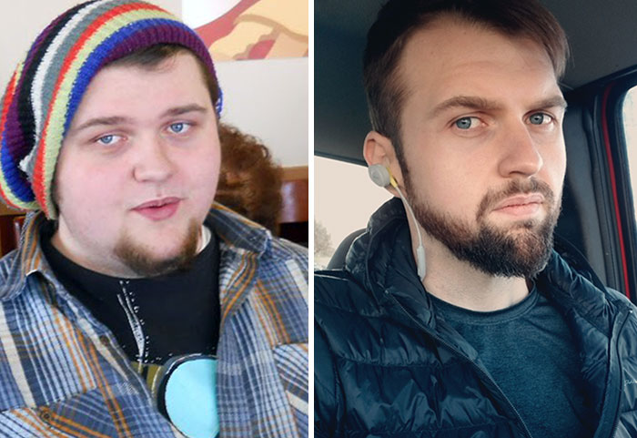 My Face And Beard Comparison Before vs. After