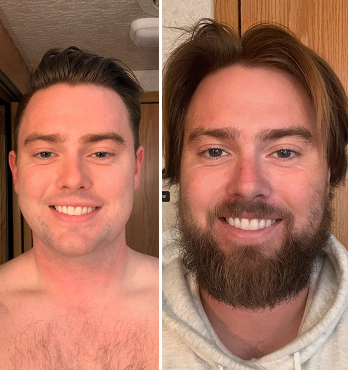 Here's My 5 Months Progress. I Absolutely Love My Beard And Hair
