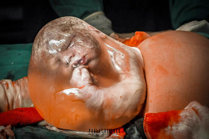 Best In Birth Details: "Waking Up At Sunrise", Paula Beltrao, Brazil