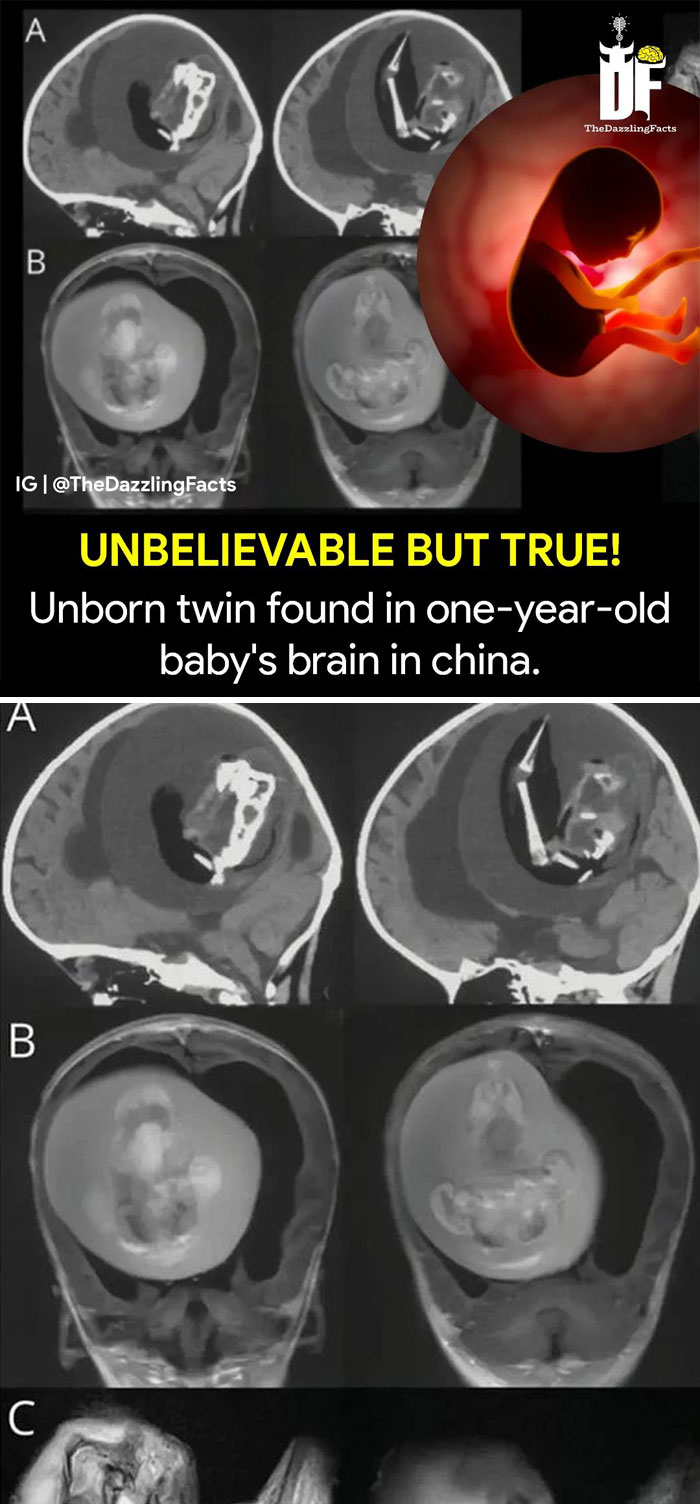 Interesting-Dazzling-Facts