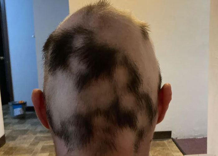 Patient Calls This Nurse's Wig "Unprofessional", Regrets It When She Takes It Off