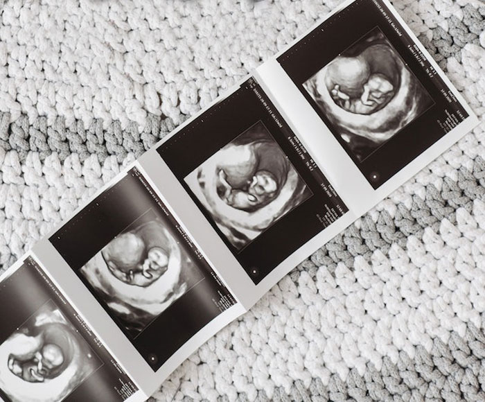 MIL Acts Suspicious After Expectant Mother&rsquo;s Sonogram Photos Go Missing