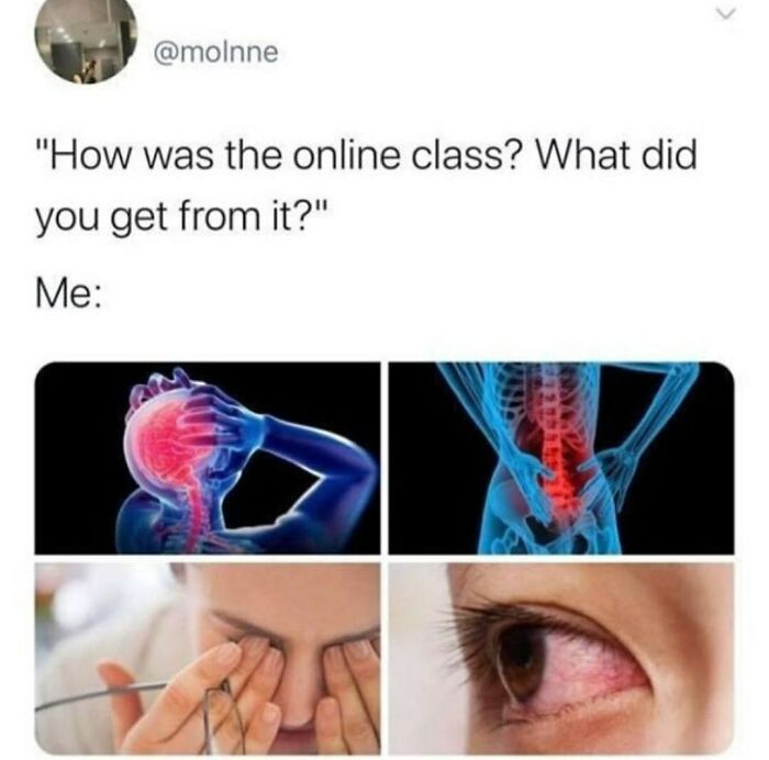 Humor State University meme showing effects of online classes: headaches, back pain, and eye strain.