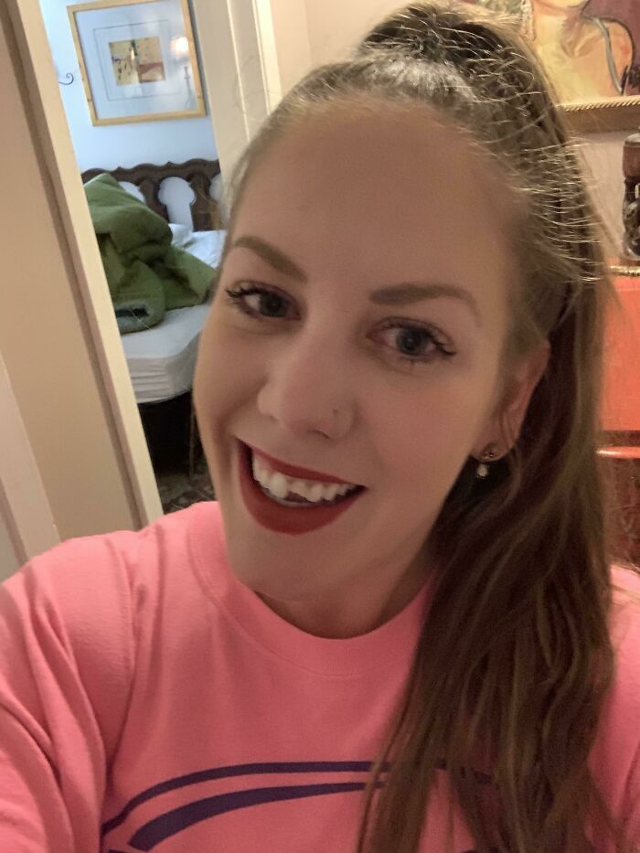 My 11 Month Old Son Just Hit Me In The Face With His Toy And Broke My Tooth In Half