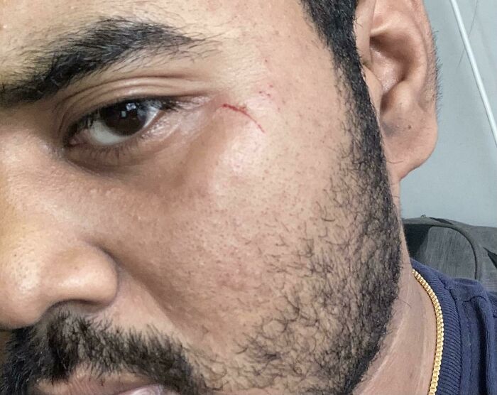 My Two-Year-Old Cousin Woke Up And Chose Violence