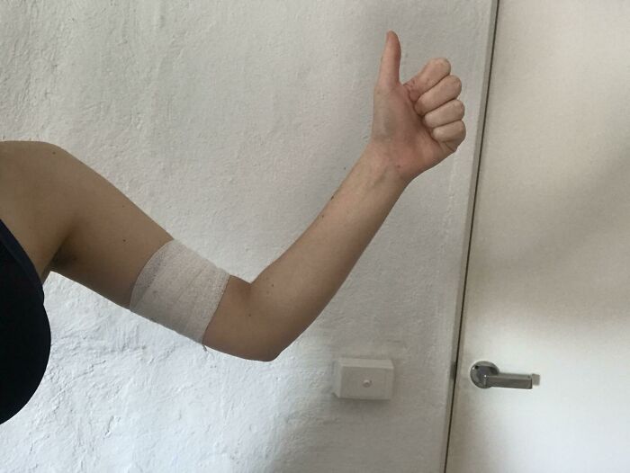 Hey Mum! I Just Went To My Doctor And Got The Arm Implant Behind Your Back. I Know You Would Kill Me If You Found Out, But I Want To Share My Excitement With Someone! (Lots Of Long Sleeve Shirts For The Next Few Days)