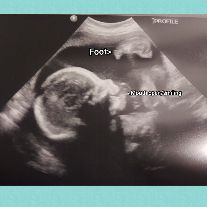 My Mom Ignored Me When I Showed Her Pictures Of The Baby Boy I'm Currently Pregnant With... Here Mom, Here's Pictures Of Baby Marley!