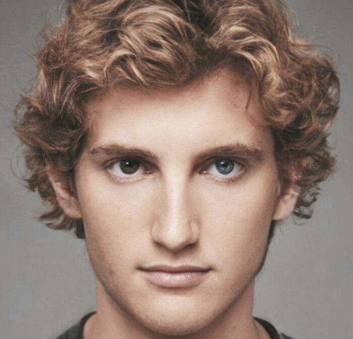 Alexander The Great 330 Bc, Facial Reconstruction From His Marble Bust