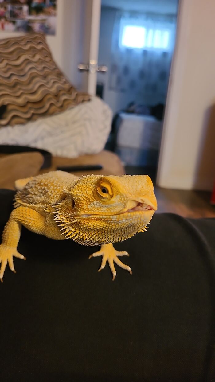 My Newly Adopted Son Cliff And His Cleft Lip