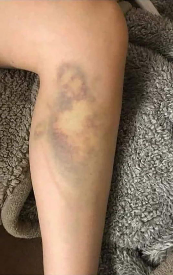 Random-Pareidolia-Face-Pics