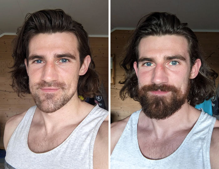 Beard Or No Beard? Be Honest Please, Because I Want To Know The Cold Truth