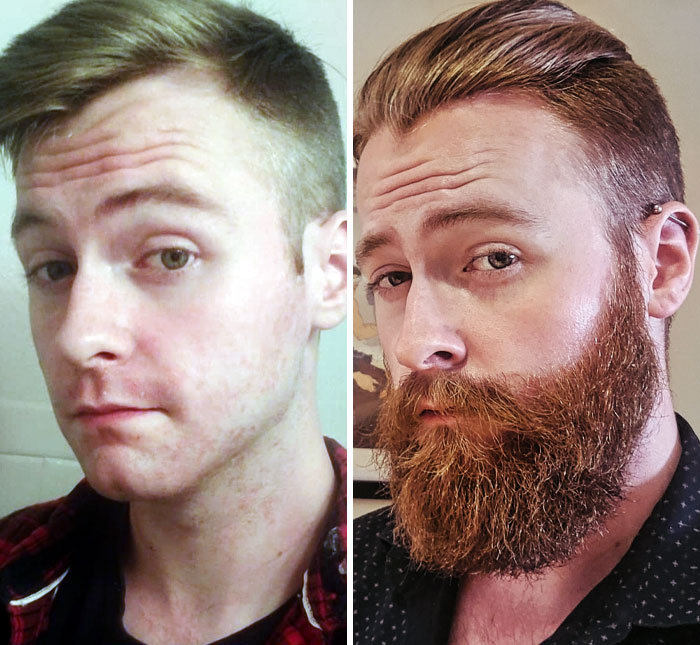 Beard vs. No Beard