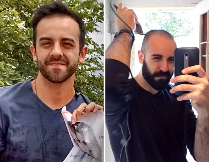 Today After A Long Time Of Insecurity With My Hair Loss, I Decided To Cut It All Off And Grow A Thicker Beard. I Recommend It To Anyone Who Needs A Boost In Confidence