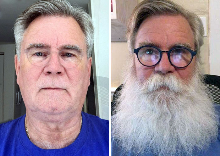 My Beard-Growing Journey. Month Zero To Nine Months