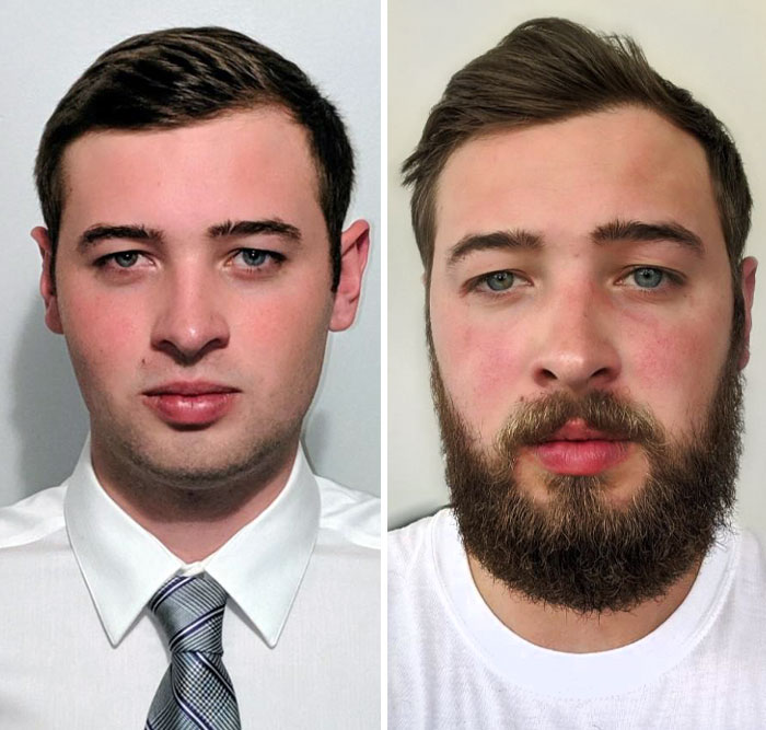 Almost 3 Months After The Last Time I Shaved