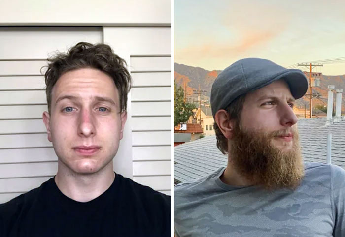 I Had To Wear An N95 For Work, So I Had To Shave My Beard