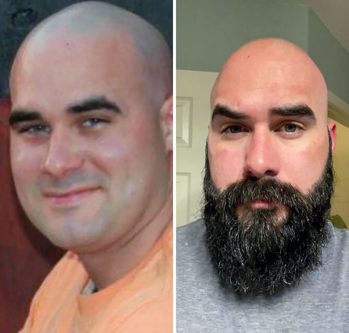 I Shouldn't Have Waited So Long To Grow A Beard. I Look Like Two Different People