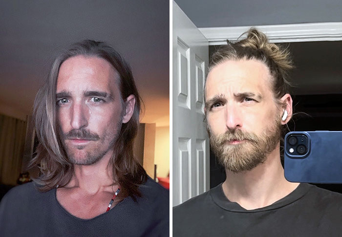I Didn't Think I Was Able To Grow A Beard, But I Did. Before And After