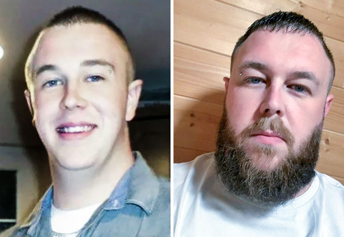 Considering A Clean Face For Summer. Yes Or No?