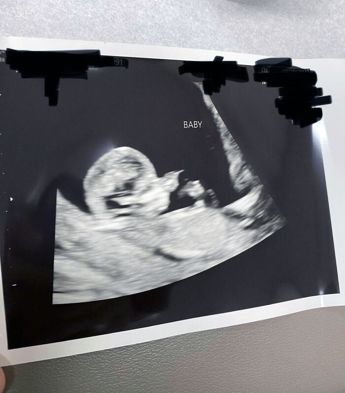 Found Out I'm Going To Be An Uncle. My Bro Is Telling Our Mom On Mother's Day