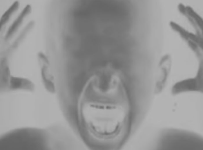 A cover of Splittercore music - black and white image with a hairless kid who is without eyes and screaming