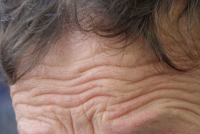 "Started Forgetting Words": 30 People Share Early Signs Of Cancer To Look Out For