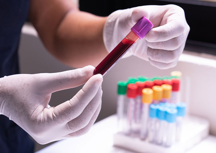 "Started Forgetting Words": 30 People Share Early Signs Of Cancer To Look Out For