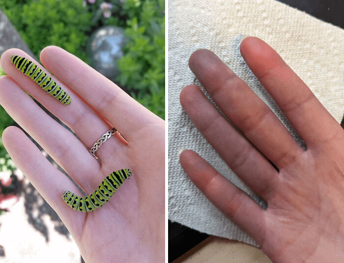 My Hand In The Summer Versus Winter - Raynaud's Phenomenon, Do Not Recommend