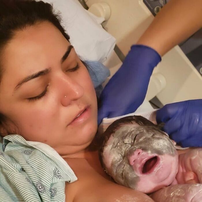 This 4-Year-Old Girl Has Undergone Multiple Surgeries To Get A Dangerous Birthmark Removed From Her Face This 4-Year-Old Girl Has Undergone Multiple Surgeries To Get A Dangerous Birthmark Removed From Her Face