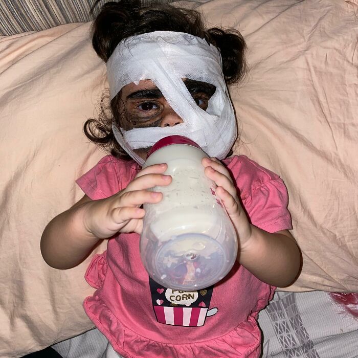 This 4-Year-Old Girl Has Undergone Multiple Surgeries To Get A Dangerous Birthmark Removed From Her Face This 4-Year-Old Girl Has Undergone Multiple Surgeries To Get A Dangerous Birthmark Removed From Her Face