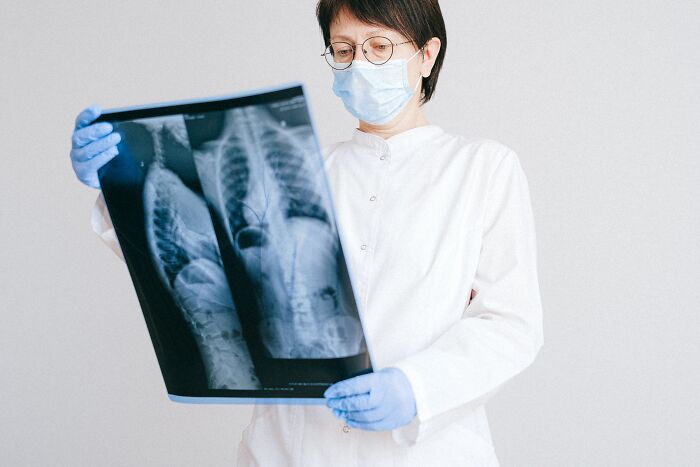Medical professional in mask and gloves examining an X-ray, focused on the worst trend in health diagnostics.