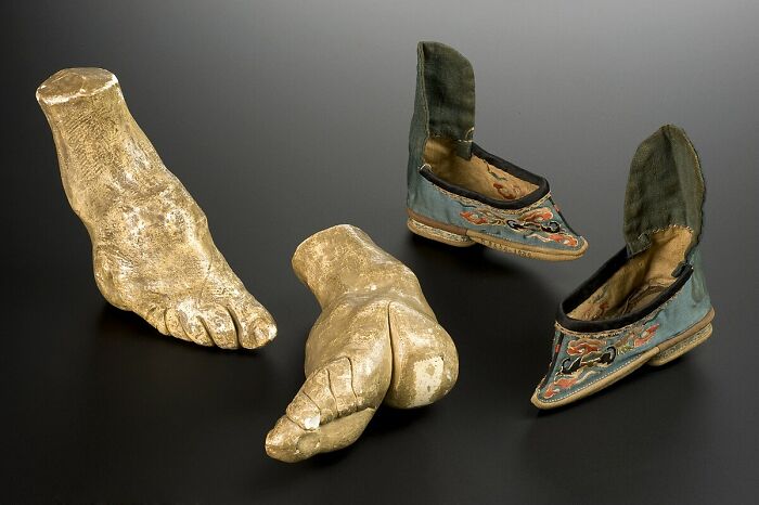 Gold foot prosthetics displayed beside vintage embroidered shoes representing the worst trend in historical footwear.