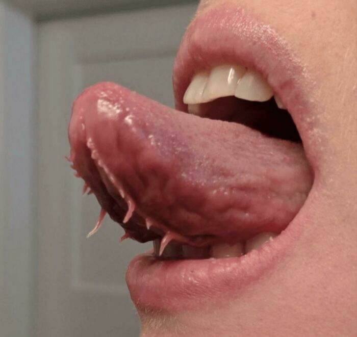 Plica Fimbriata Doesn't Hurt Or Harm A Person But Personally I Think It Fits Here