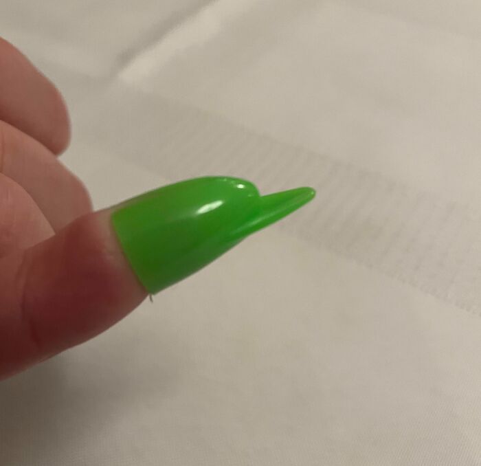 My Son Got An Artificial Coke Nail In His Christmas Cracker