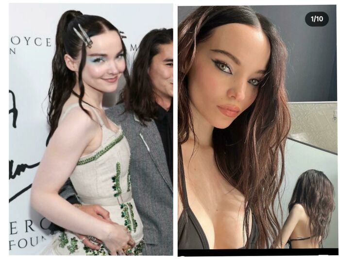 The Arm... Both Pics Are Very Recent