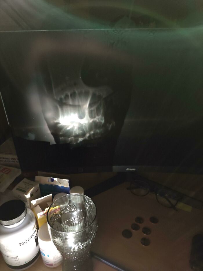 The Reflection Of The Light Through A Coca Cola Glass Looks Like A Skull With Teeth. Made Me Jump For A Sec