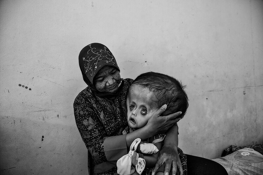 The Series "Mercury Poisoning In Indonesia" By Erberto Zani (Switzerland)