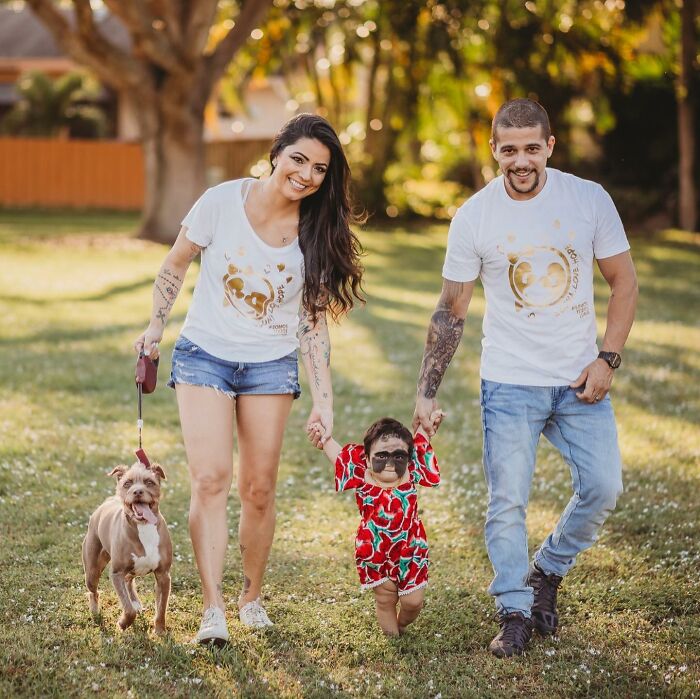 This 4-Year-Old Girl Has Undergone Multiple Surgeries To Get A Dangerous Birthmark Removed From Her Face This 4-Year-Old Girl Has Undergone Multiple Surgeries To Get A Dangerous Birthmark Removed From Her Face