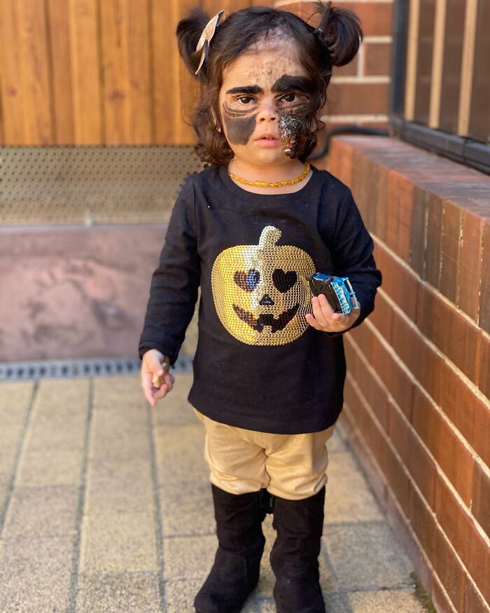 This 4-Year-Old Girl Has Undergone Multiple Surgeries To Get A Dangerous Birthmark Removed From Her Face This 4-Year-Old Girl Has Undergone Multiple Surgeries To Get A Dangerous Birthmark Removed From Her Face